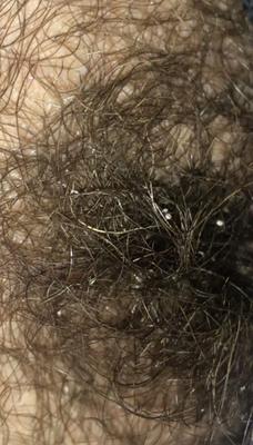 my dirty hairy wife new pics