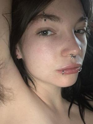 This Skinny, Hairy Alt Girl