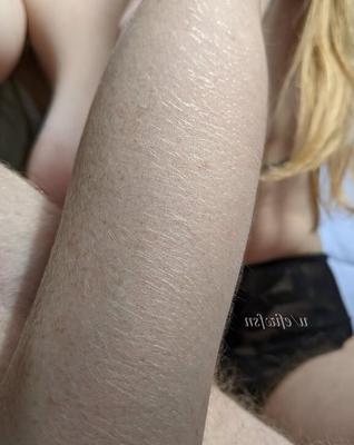 Hairy Arms IX