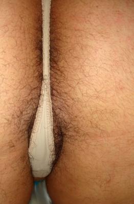 Hairy Holes XLIV