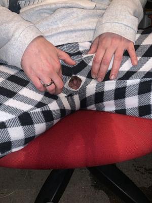 La femme a un trou dans son pantalon de pyjama