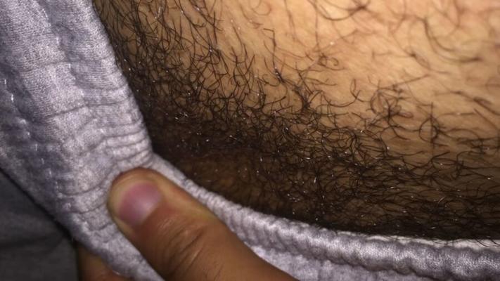 Pêlos pubianos raspados e com barba por fazer