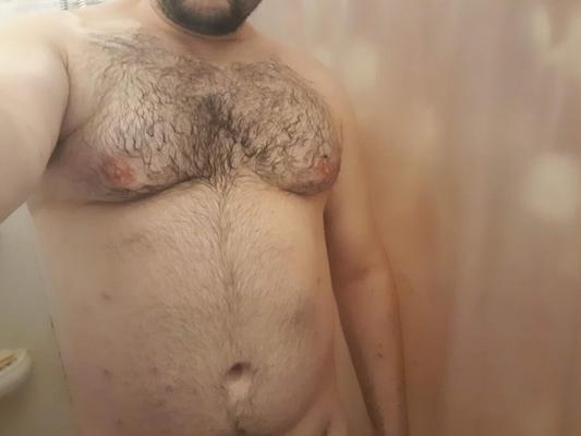 My hairy body