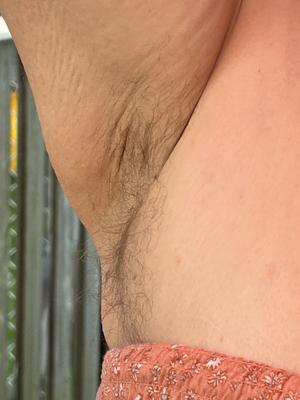 Real hairy pits